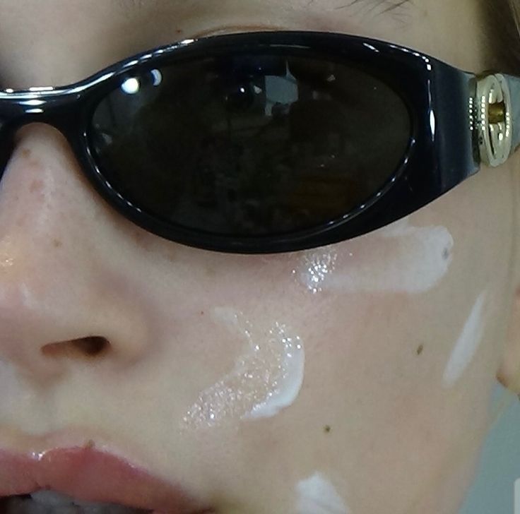 what sugar actually does to your skin (and why it shows up on your face)